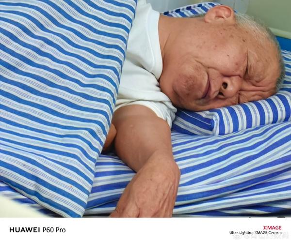 7岁女生有黄色分泌物正常吗的相关介绍